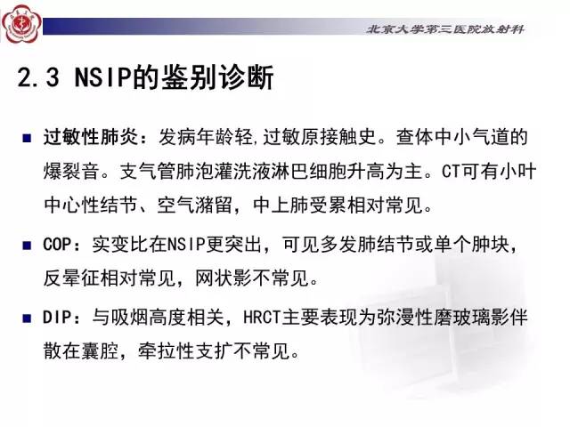 【病例】特发性间质性肺炎2例影像表现
