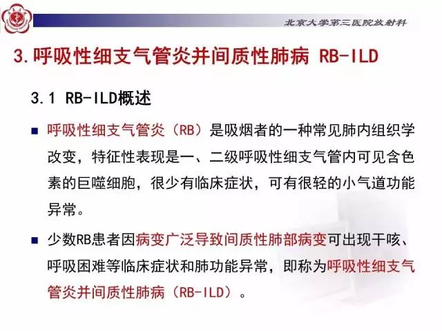 【病例】特发性间质性肺炎2例影像表现