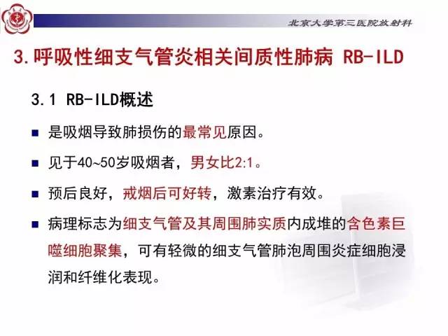 【病例】特发性间质性肺炎2例影像表现