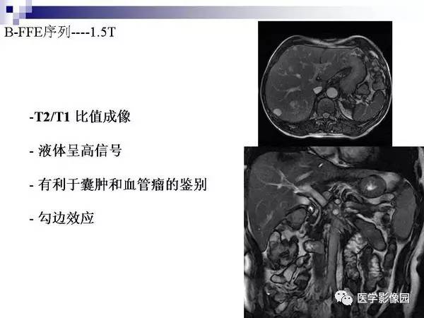 【PPT】肝占位病变影像诊断思路