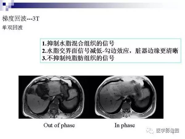 【PPT】肝占位病变影像诊断思路