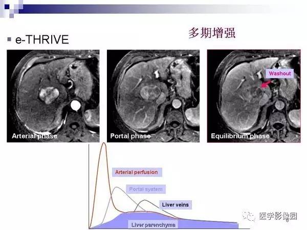 【PPT】肝占位病变影像诊断思路
