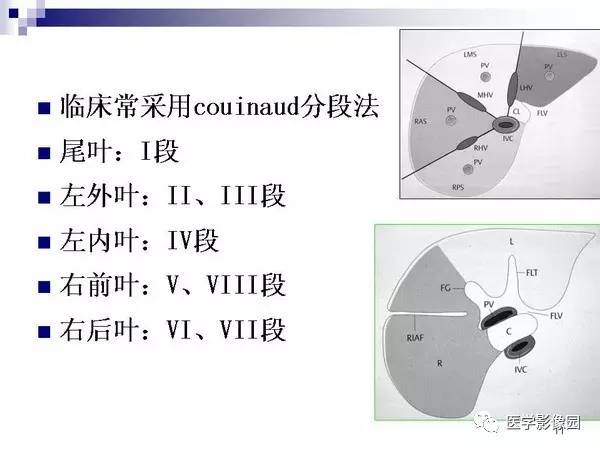 【PPT】肝占位病变影像诊断思路