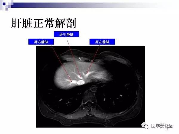 【PPT】肝占位病变影像诊断思路