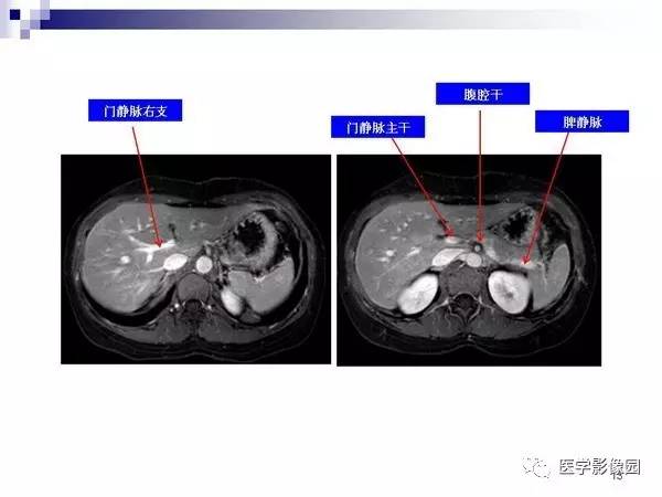 【PPT】肝占位病变影像诊断思路