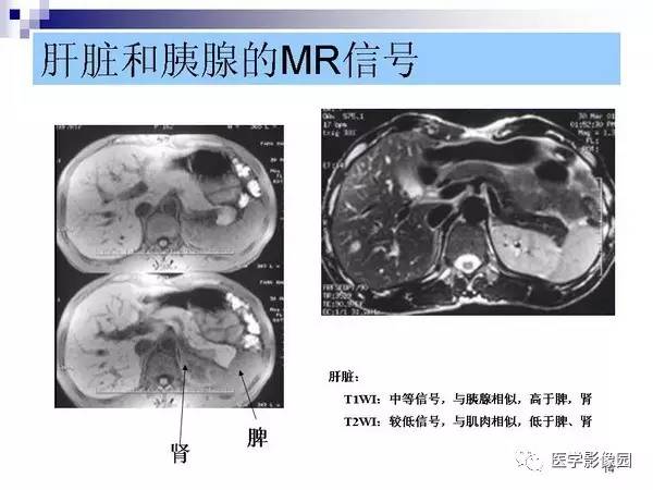 【PPT】肝占位病变影像诊断思路