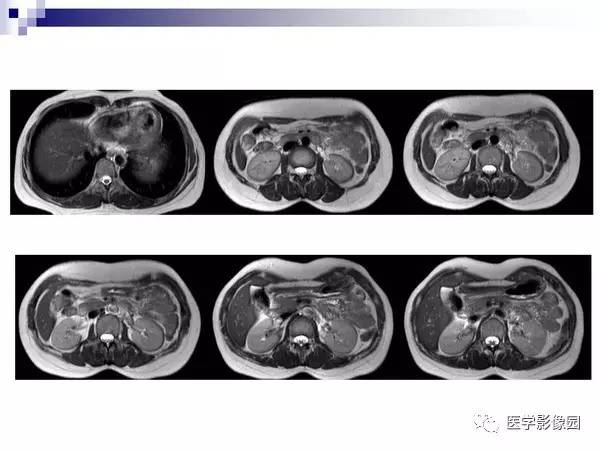 【PPT】肝占位病变影像诊断思路