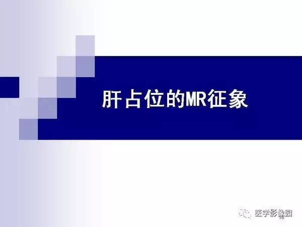 【PPT】肝占位病变影像诊断思路