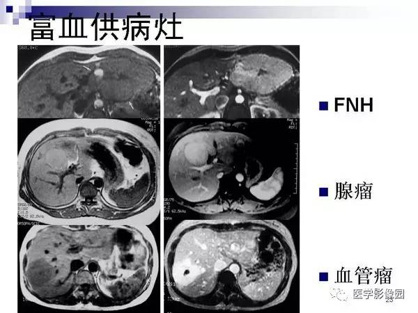 【PPT】肝占位病变影像诊断思路