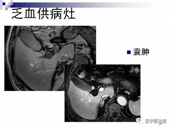 【PPT】肝占位病变影像诊断思路
