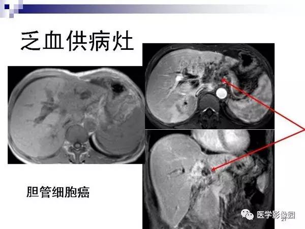 【PPT】肝占位病变影像诊断思路