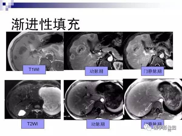 【PPT】肝占位病变影像诊断思路