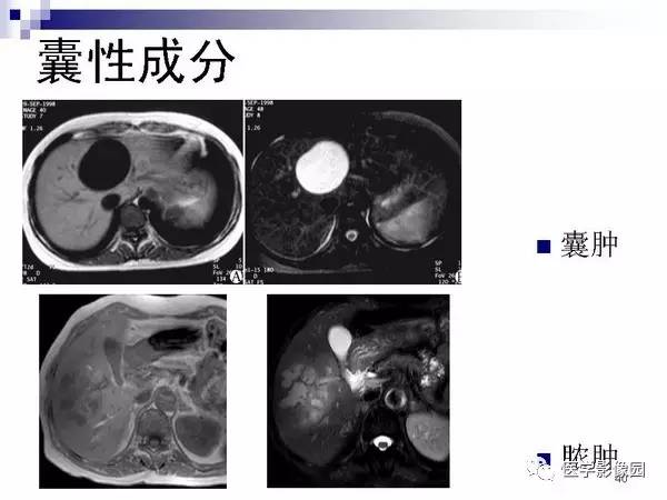 【PPT】肝占位病变影像诊断思路