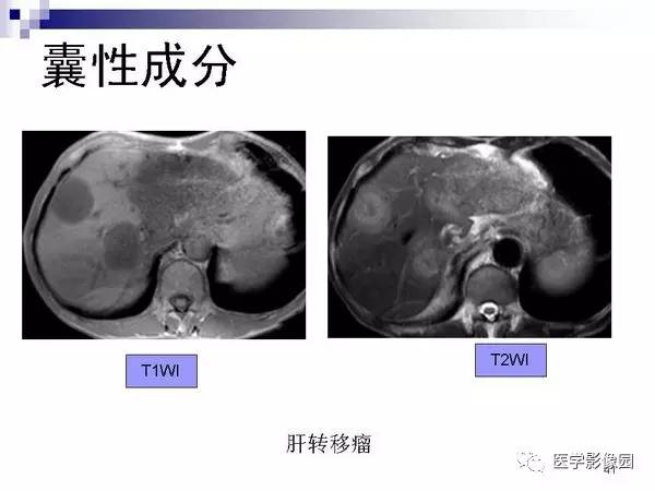 【PPT】肝占位病变影像诊断思路