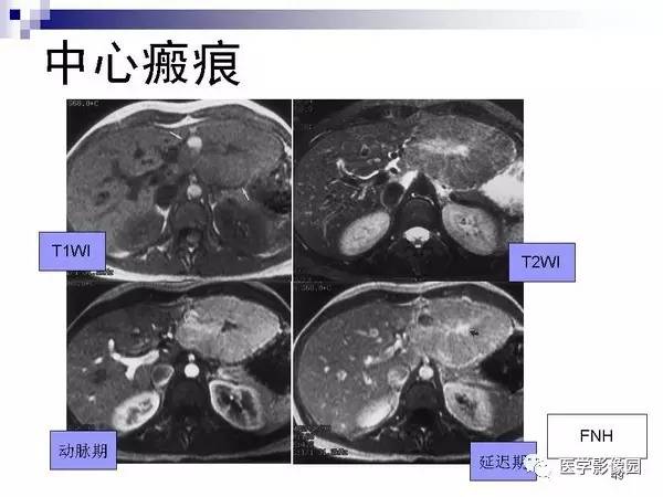 【PPT】肝占位病变影像诊断思路