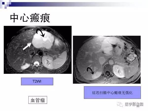 【PPT】肝占位病变影像诊断思路