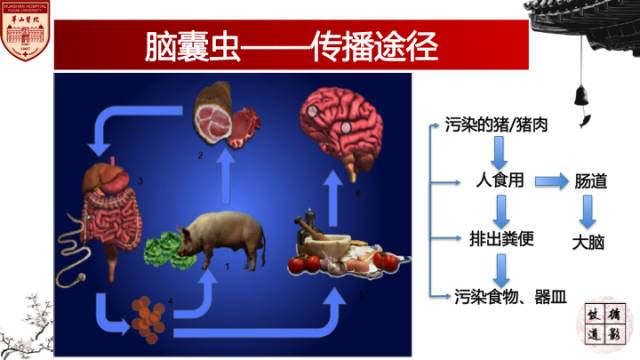 【病例】脑囊虫病1例MR影像诊断