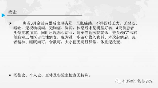 【病例】右侧颞叶室管膜下瘤1例MR