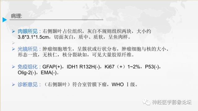 【病例】右侧颞叶室管膜下瘤1例MR