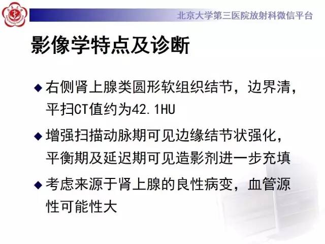 【病例】肾上腺血管瘤1例CT影像表现