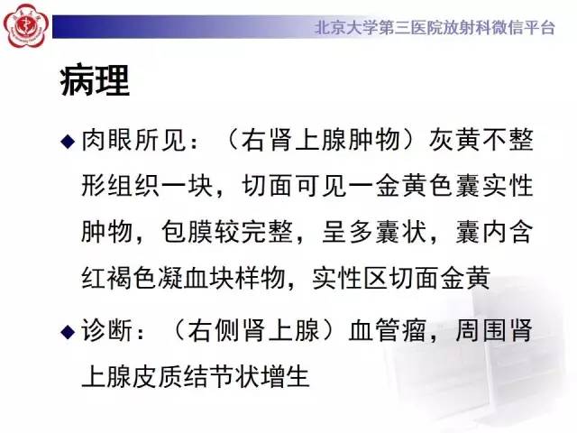 【病例】肾上腺血管瘤1例CT影像表现