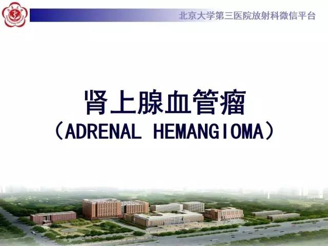 【病例】肾上腺血管瘤1例CT影像表现