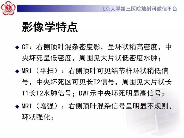 【病例】脑脓肿1例CT及MR影像诊断