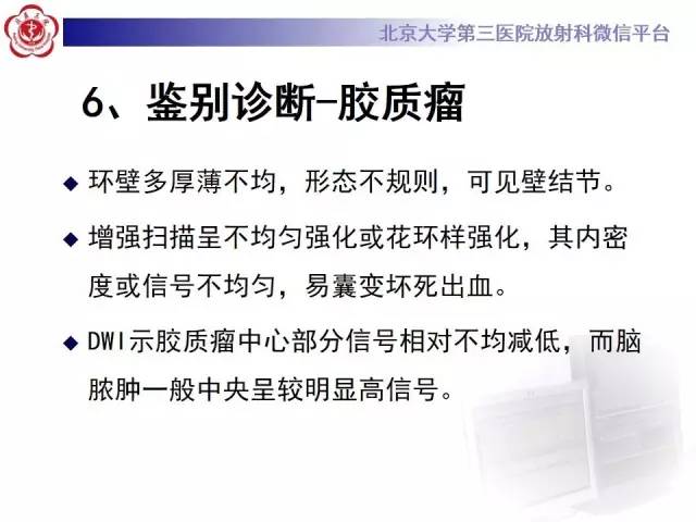 【病例】脑脓肿1例CT及MR影像诊断