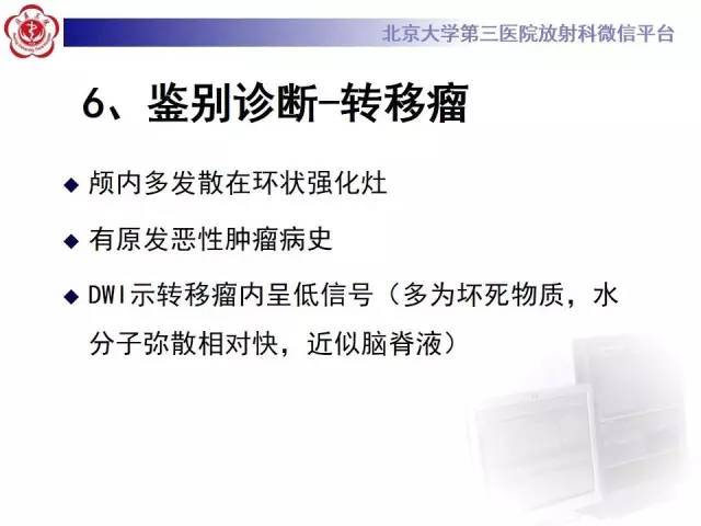 【病例】脑脓肿1例CT及MR影像诊断