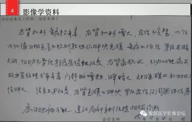 【病例】肾脏少见炎性肉芽肿伴放线菌病1例CT