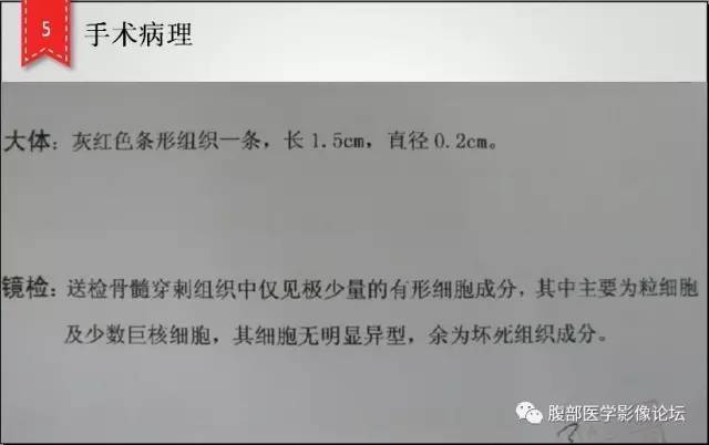 【病例】肾脏少见炎性肉芽肿伴放线菌病1例CT