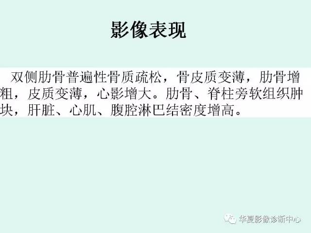 【病例】地中海贫血一例CT