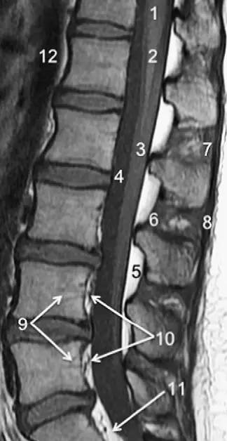 MRI 下脊椎基本解剖集锦：胸腰椎