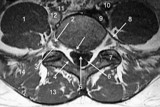 MRI 下脊椎基本解剖集锦：胸腰椎