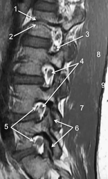 MRI 下脊椎基本解剖集锦：胸腰椎