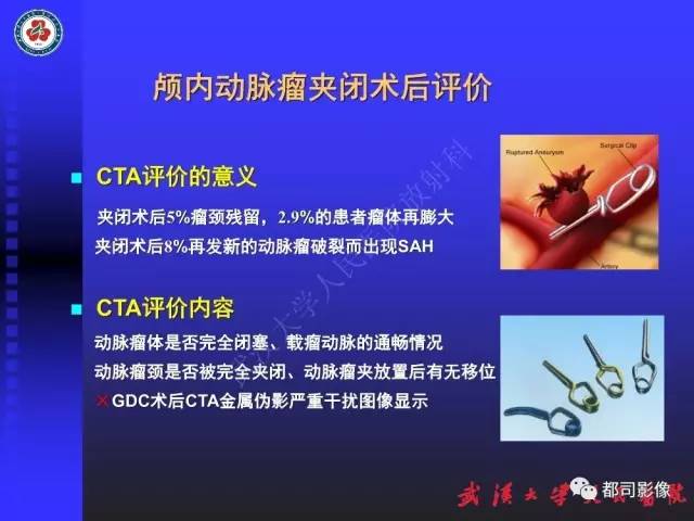 【PPT】CTA在血管病变术后评价中的应用