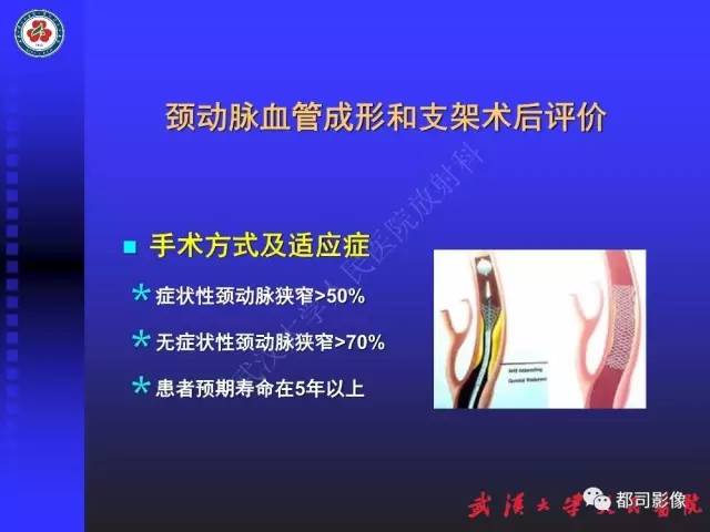 【PPT】CTA在血管病变术后评价中的应用