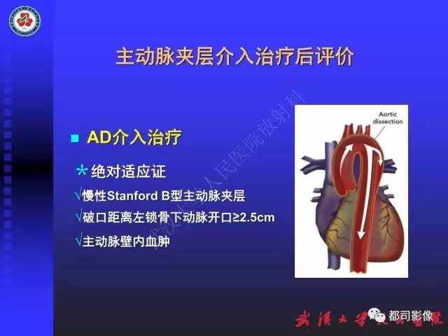 【PPT】CTA在血管病变术后评价中的应用
