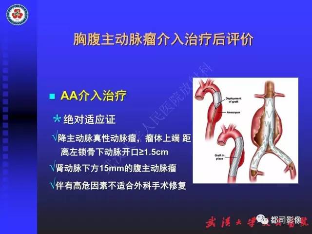 【PPT】CTA在血管病变术后评价中的应用