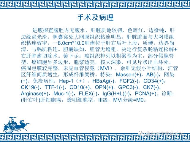 【病例】肝右叶肝透明细胞癌1例CT及MR