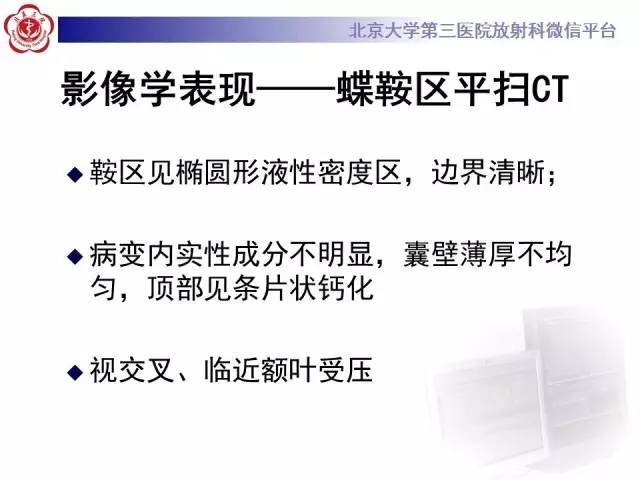 【病例】颅咽管瘤1例CT及MR影像表现