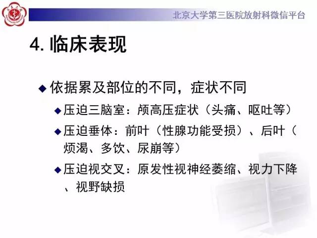 【病例】颅咽管瘤1例CT及MR影像表现