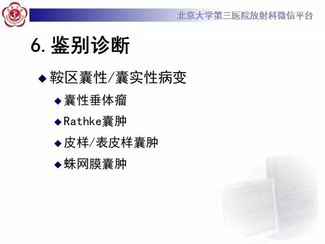 【病例】颅咽管瘤1例CT及MR影像表现