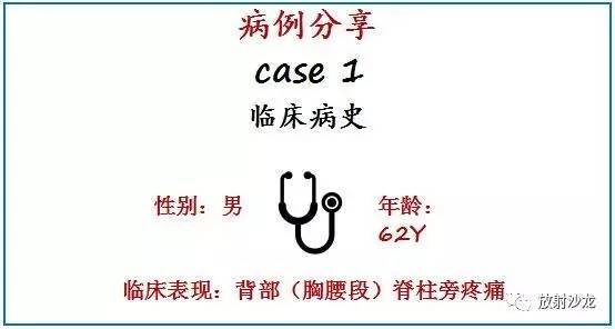 神经中轴钙化性假瘤的影像诊断及鉴别诊断