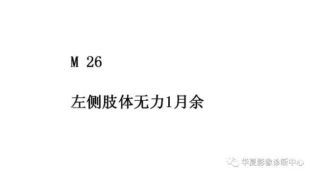 【病例】鞍旁脊索瘤1例CT及MR
