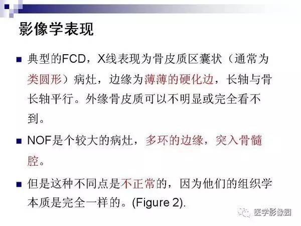 【PPT】非骨化性纤维瘤影像诊断