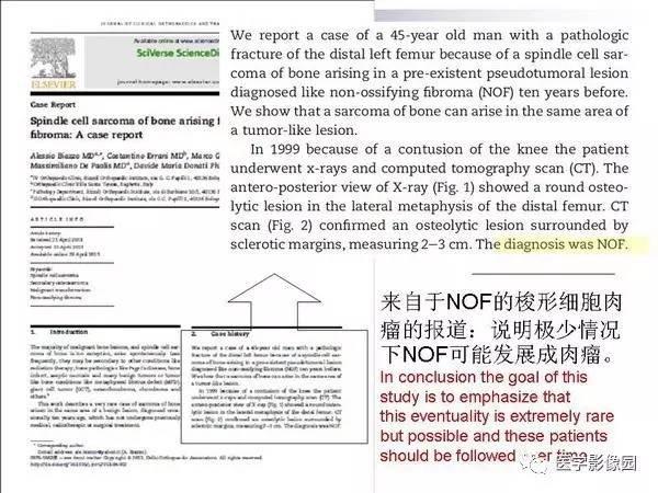 【PPT】非骨化性纤维瘤影像诊断