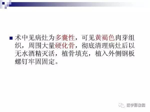 【PPT】非骨化性纤维瘤影像诊断