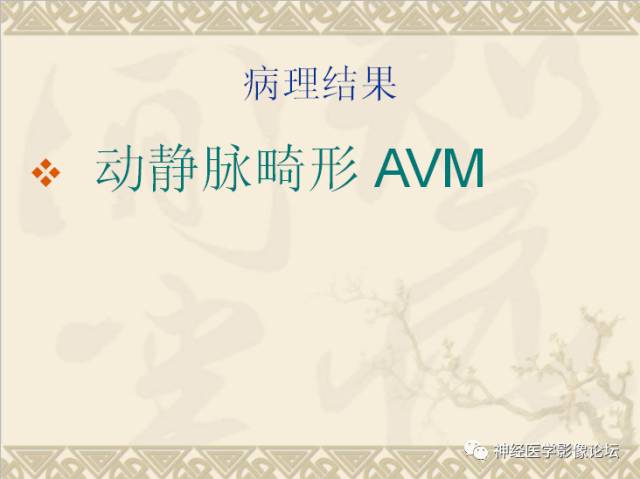 【病例】动静脉畸形一例MR