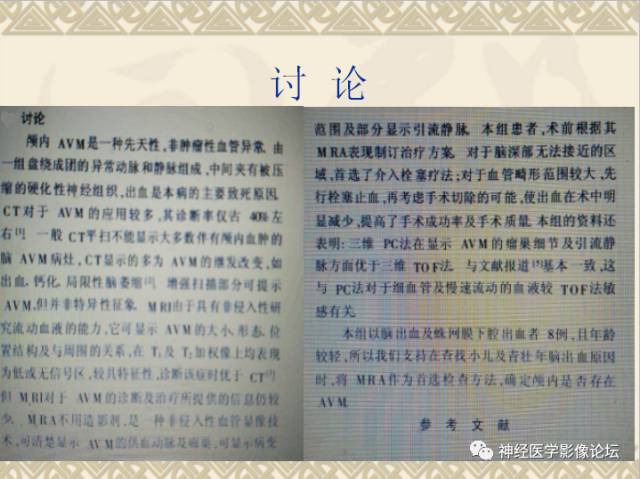 【病例】动静脉畸形一例MR